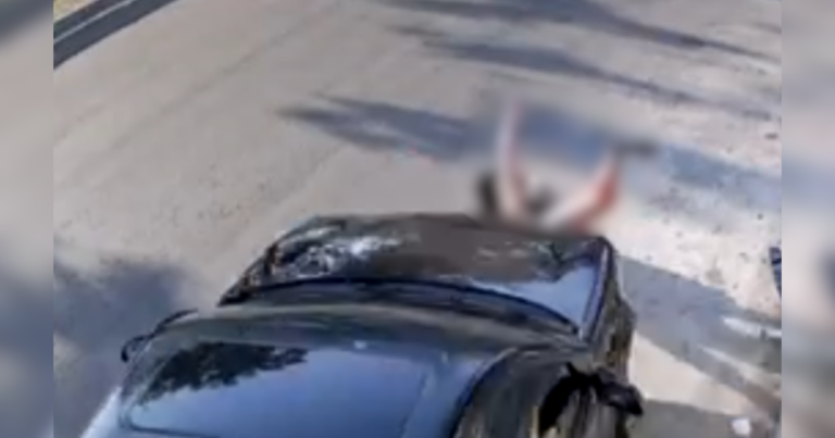 “Ficar sem as pernas por causa de um homem desse”, lamenta amiga