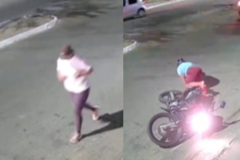 Mulher atropelada por motocicleta durante ‘grau’ vai precisar amputar as duas pernas