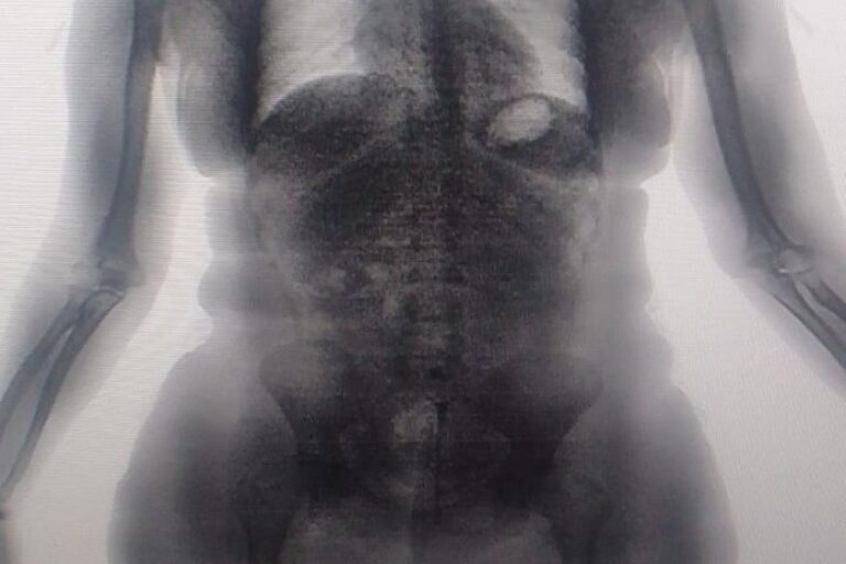 Visitante é flagrada pelo BodyScan tentando entrar com drogas escondidas em presídio na RMS