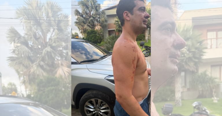 Morador denúncia agressão por atleta do Fortaleza em condomínio de luxo