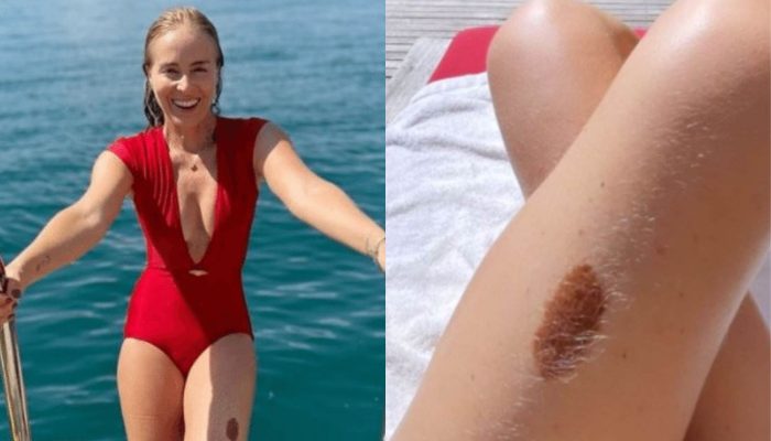 Angélica faz confissão inesperada sobre ‘pinta famosa’