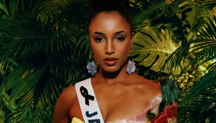Miss-Jamaica-sera-repatriada-apos-sofrer-acidente-grave-no-Miss.webp.webp