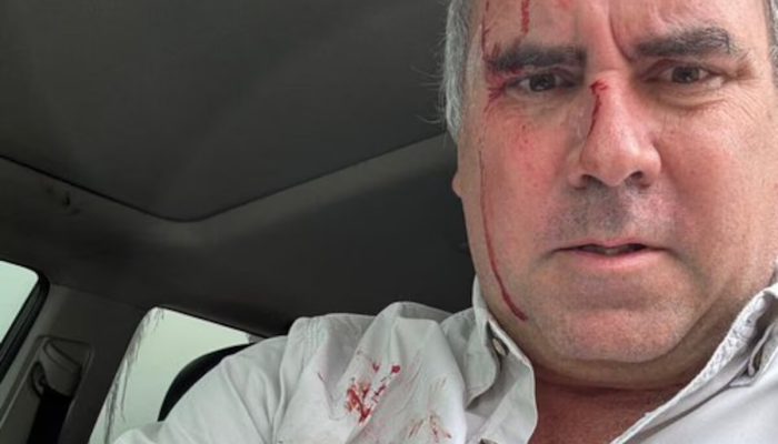 Pré-candidato à Presidência do Peru sofre ataque armado