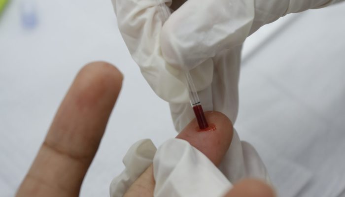 Registro de HIV entre idosos aumenta 441% em 10 anos