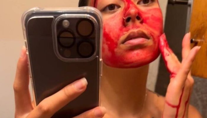 nova tendência de skincare? Entenda os riscos